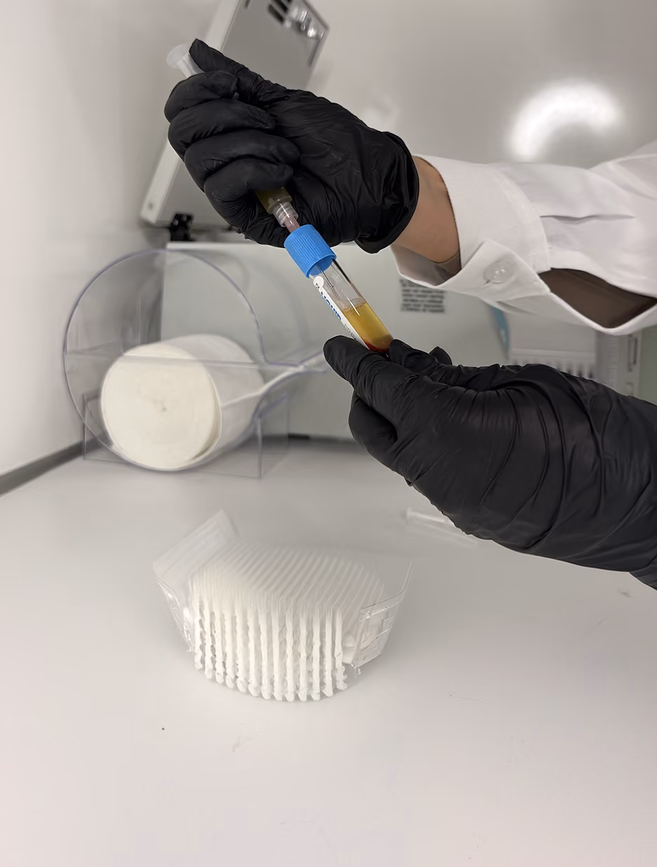 Person wearing black gloves and a white lab coat using a pipette to draw liquid from a test tube with a blue cap in a clean laboratory setting with cotton pads in the background.
