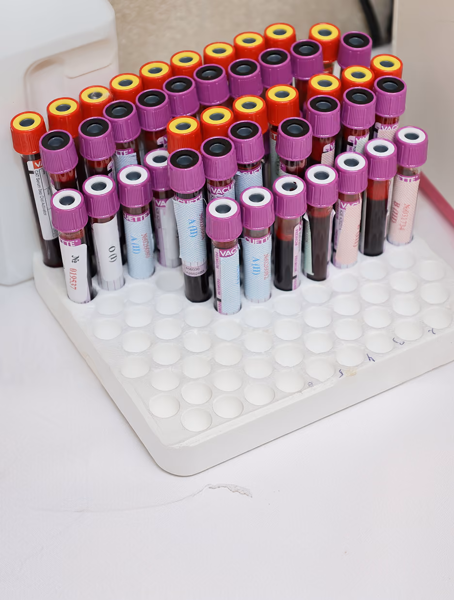 Multiple blood sample tubes with purple and red caps, placed upright in a white plastic test tube rack on a light surface.