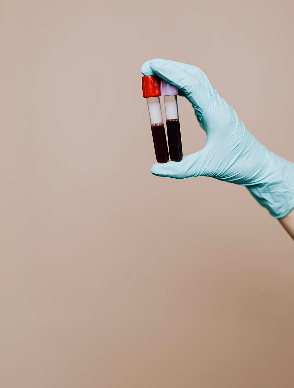 Hand wearing a blue medical glove holding two blood sample tubes with red and purple caps against a plain beige background.