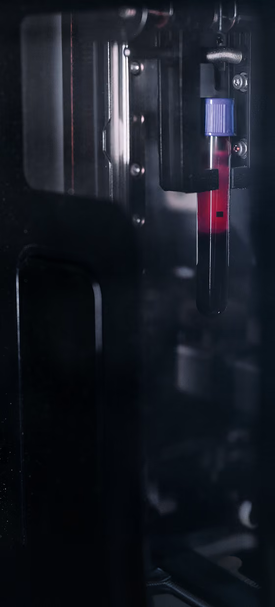 Close-up of a blood collection tube with a purple cap containing dark red blood, held by an automated medical laboratory machine.