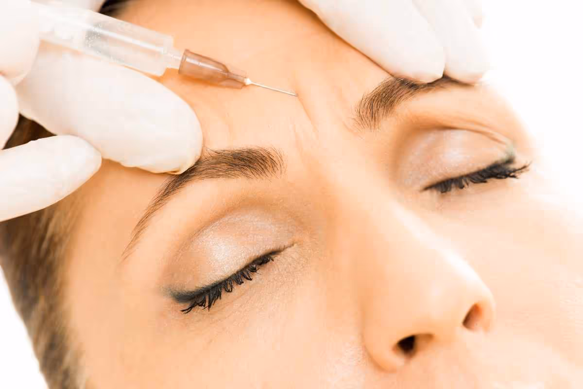 Botox injections
