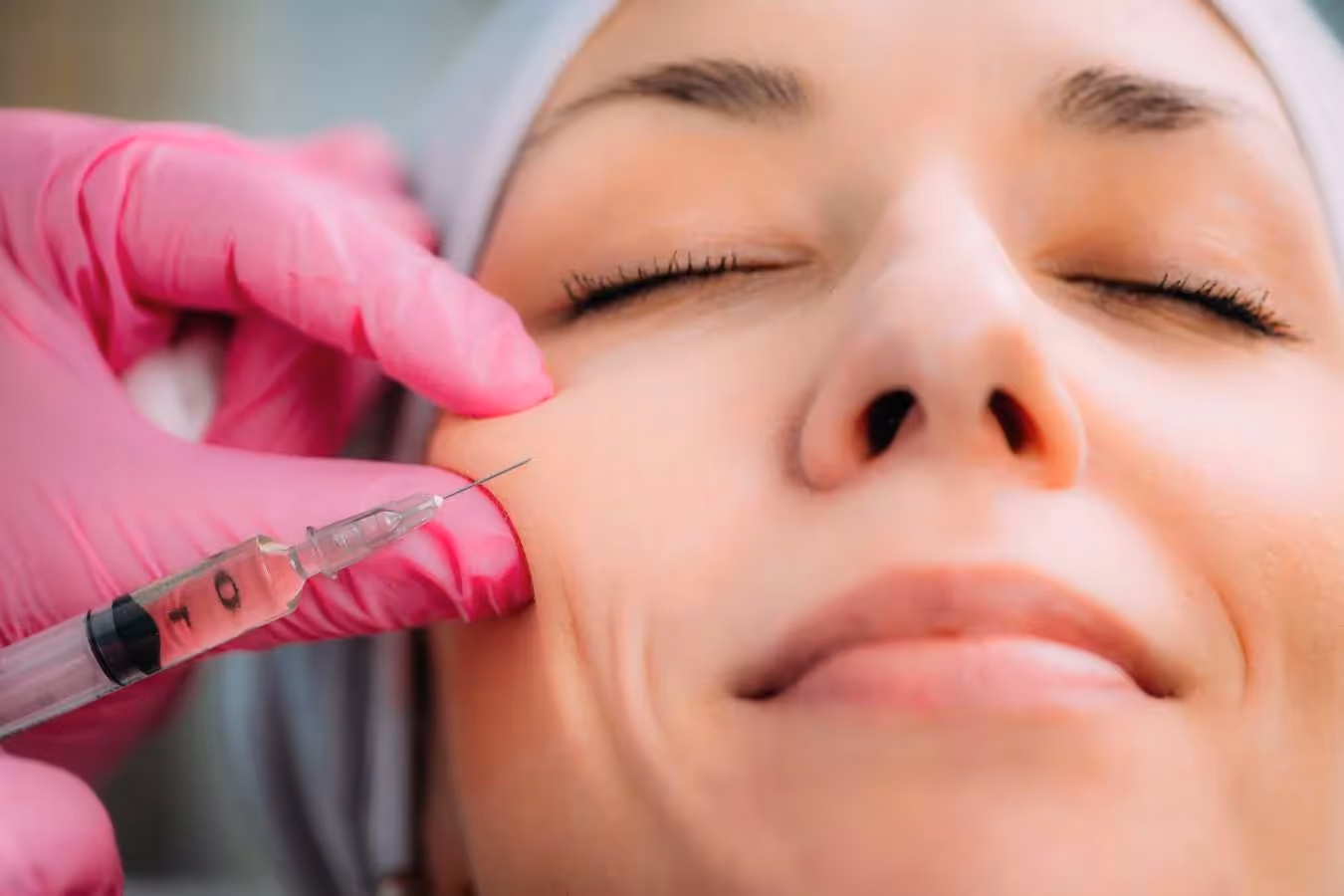 Dermal fillers