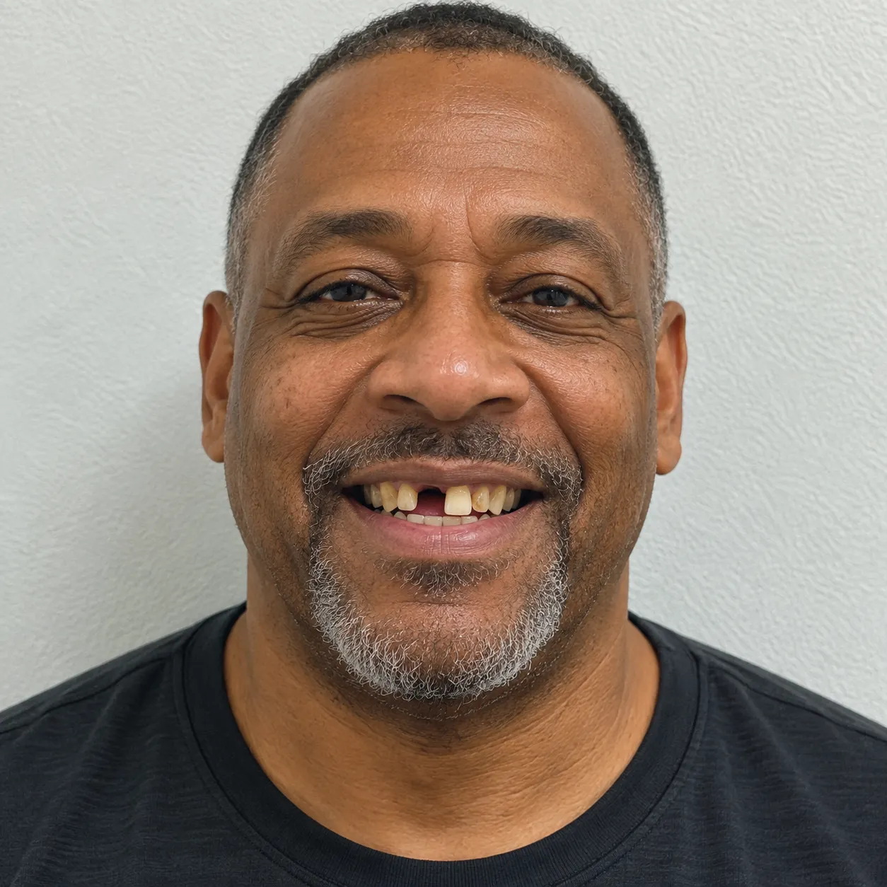 African American man in his 50s smiling with visible gaps, missing teeth, and discoloration before dental treatment.