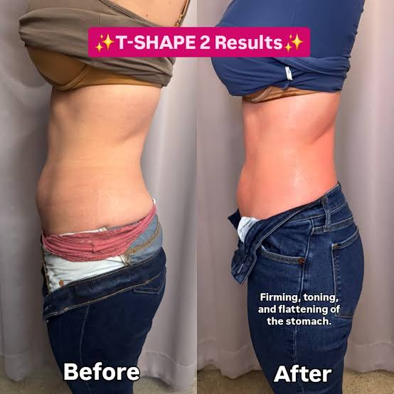 Noninvasive body contouring treatment