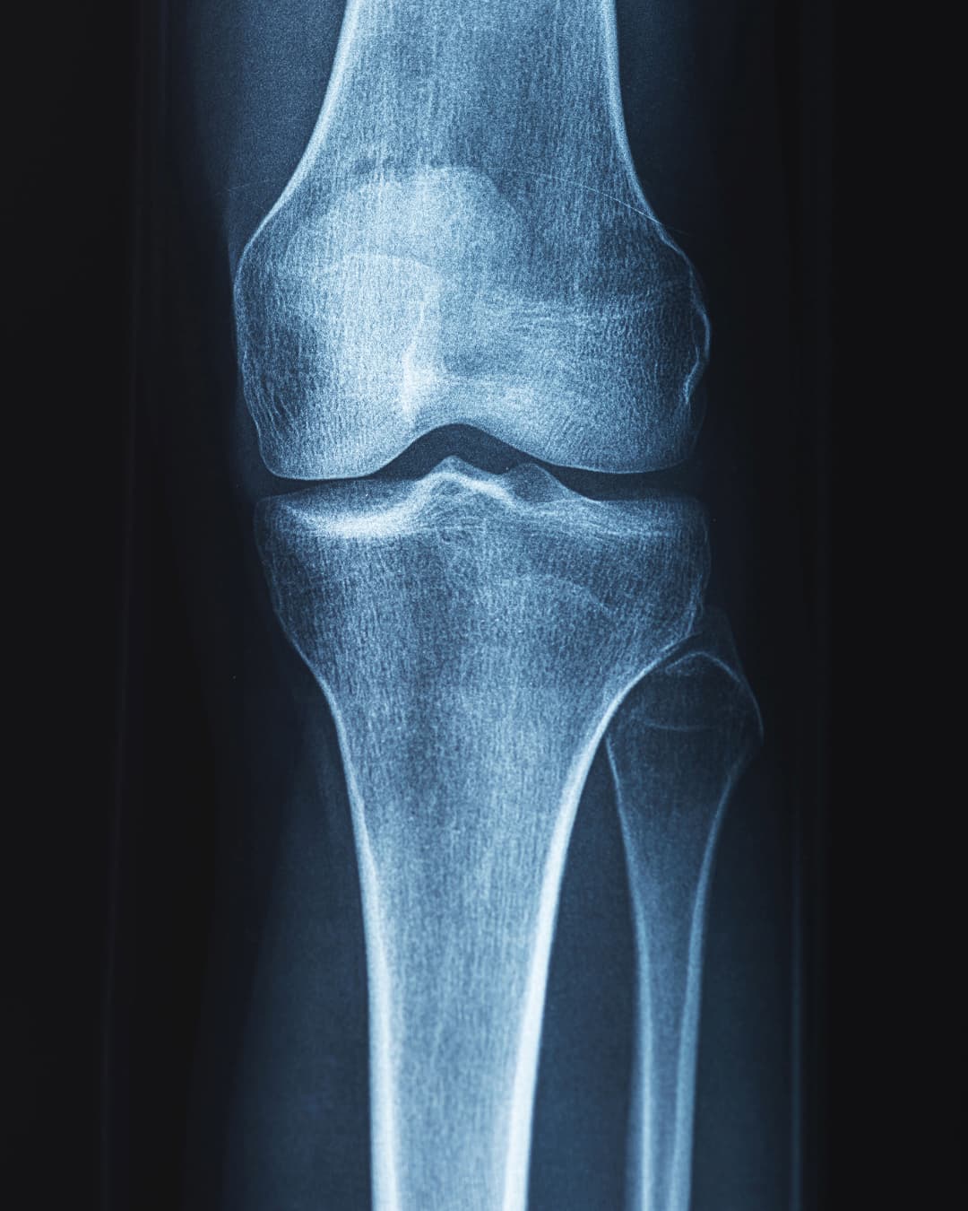 Rheumatology