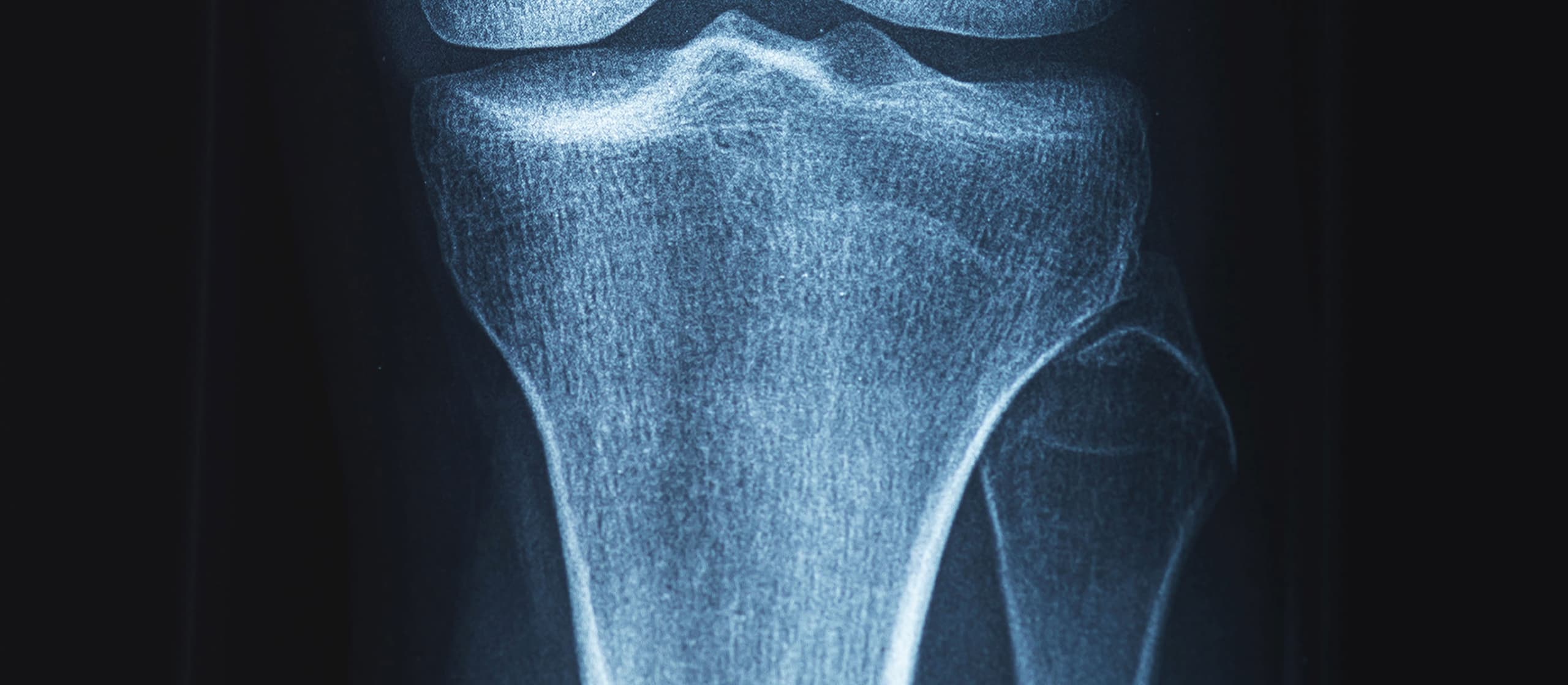 Rheumatology