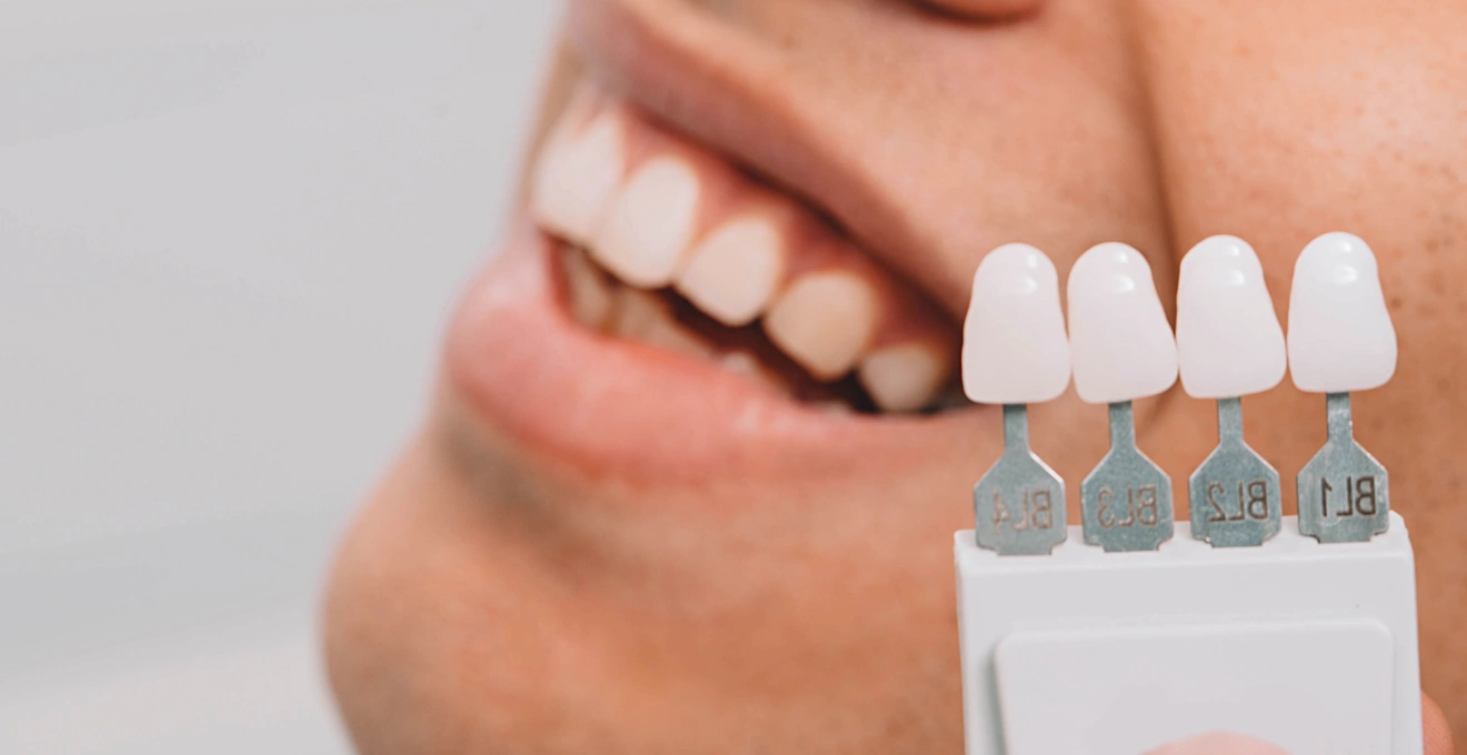 Veneer Maintenance