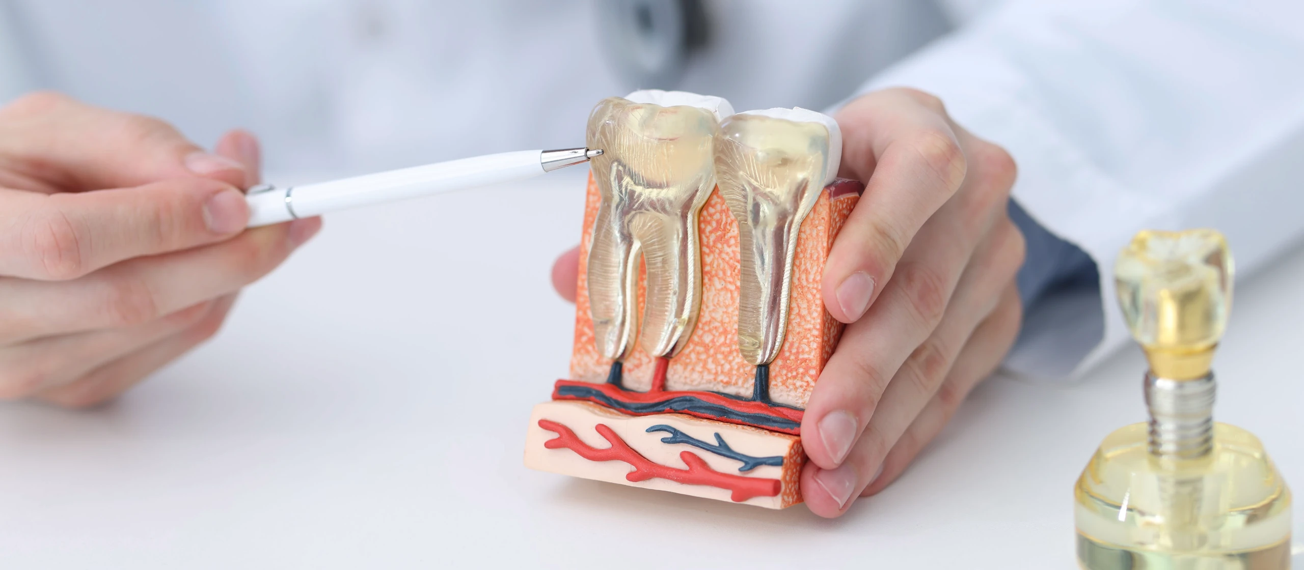 Dental implants