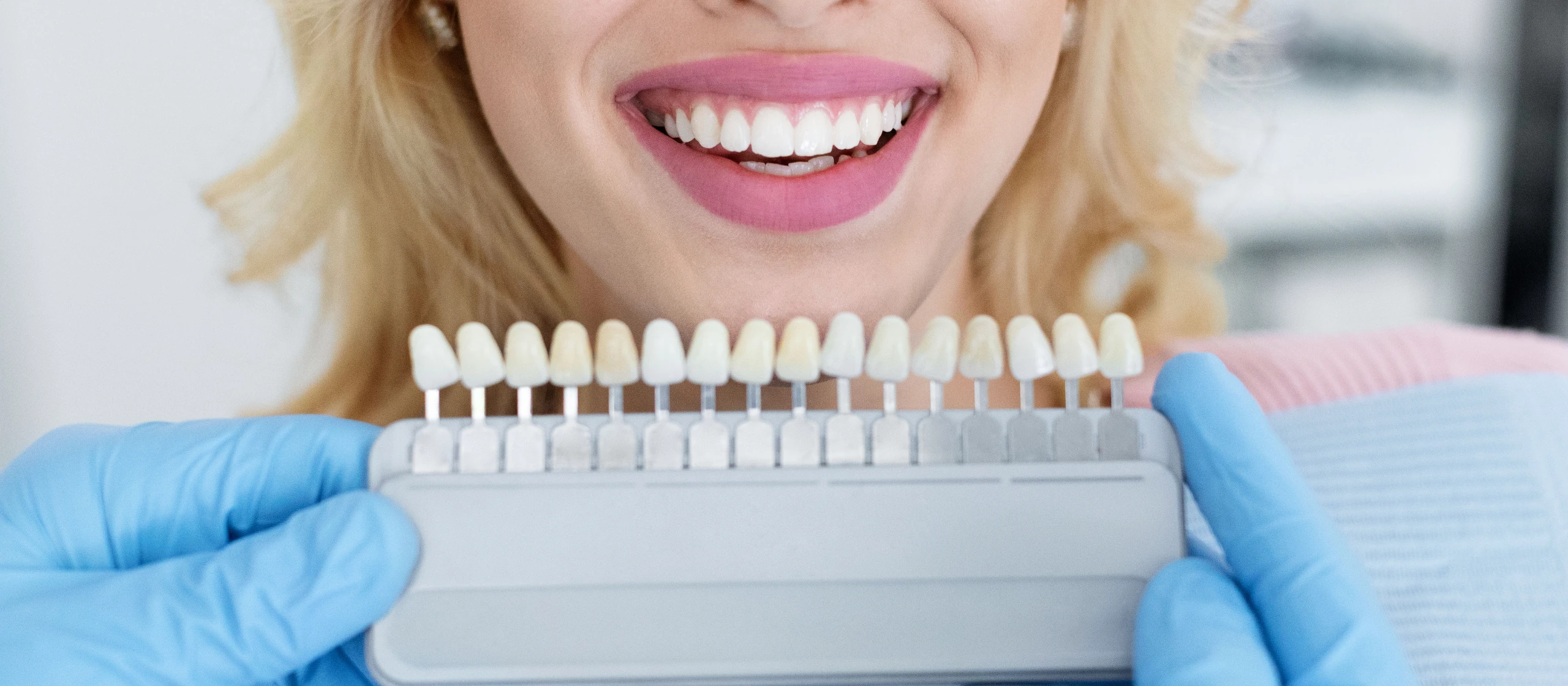 Veneers