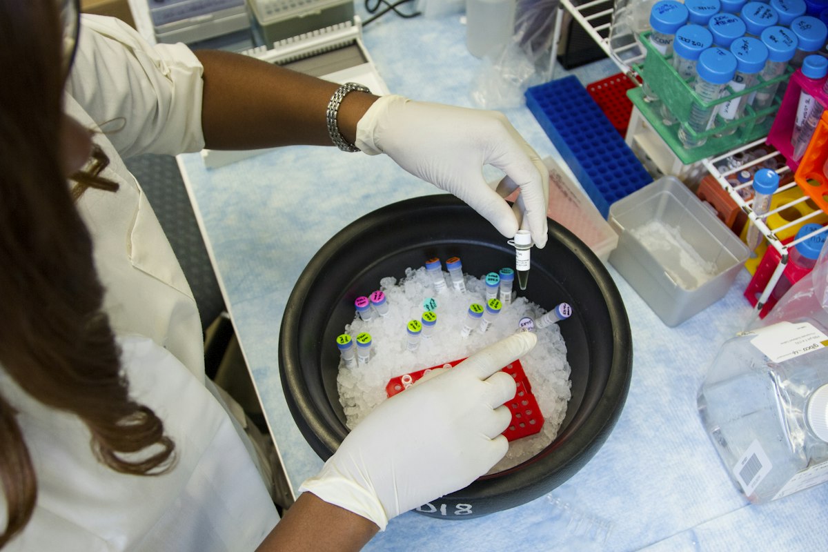 Hormone testing lab work
