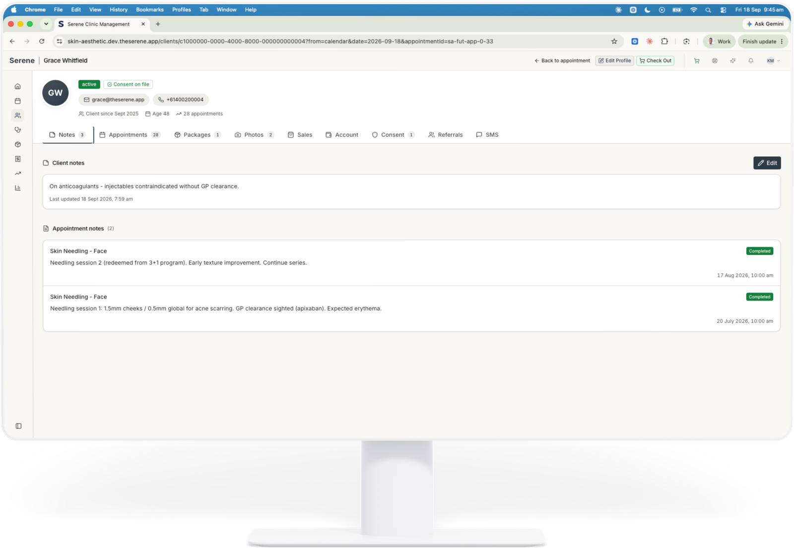 Serene client record showing clinical notes, appointment history and consent status