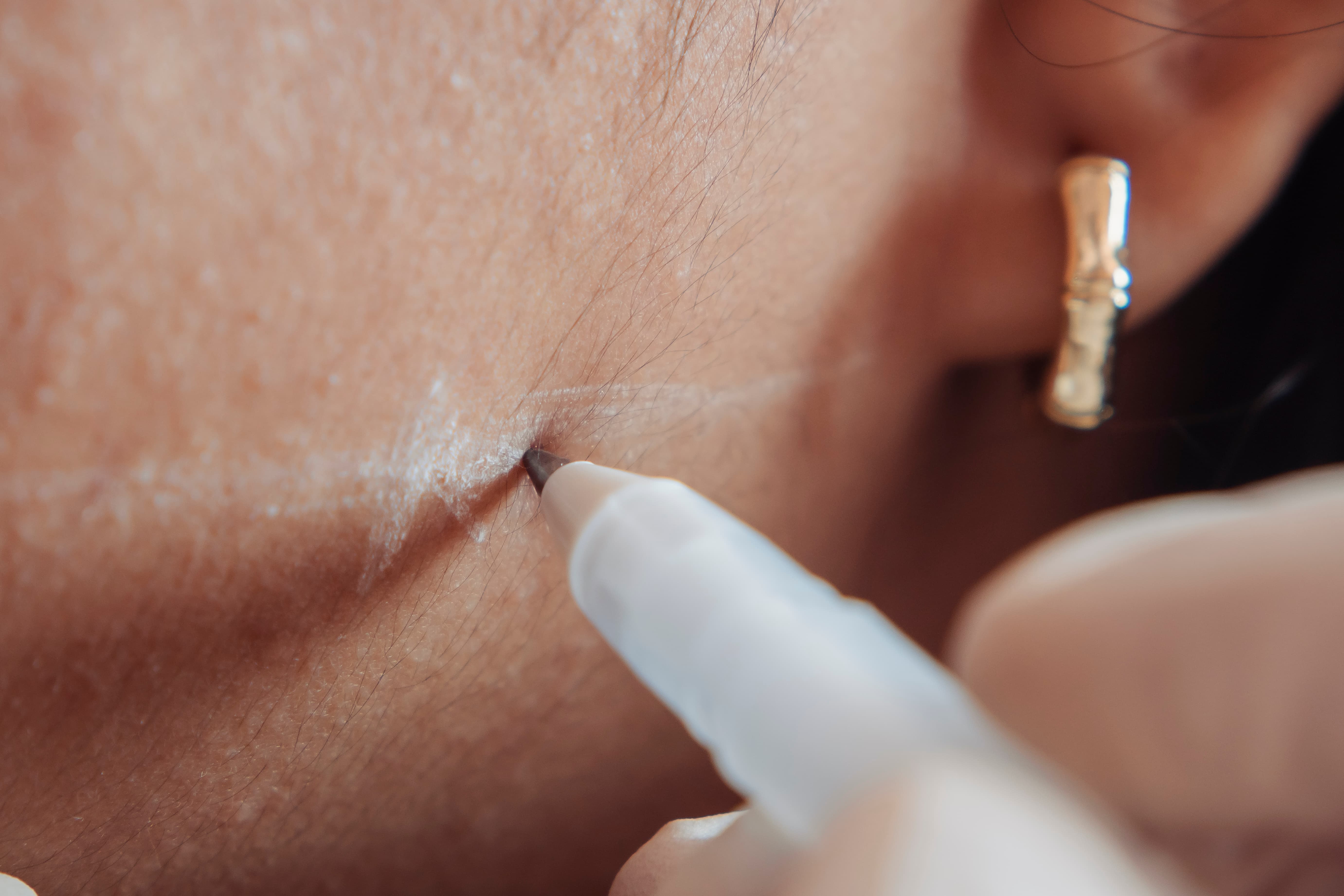 Facial Mapping & Structural Assessment at Skin Conserv by Yve in Park City, UT