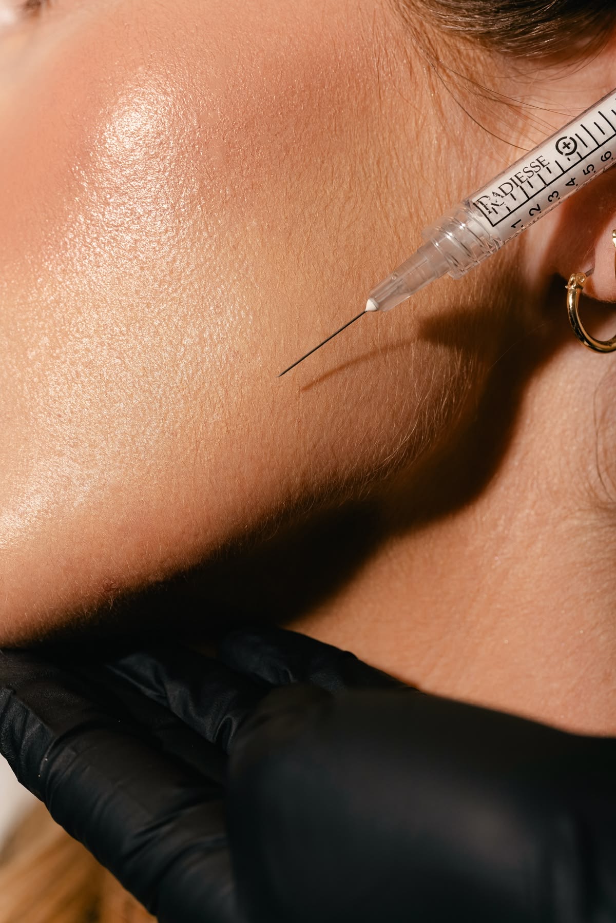 Sculptra at Skin Conserv by Yve in Park City, UT