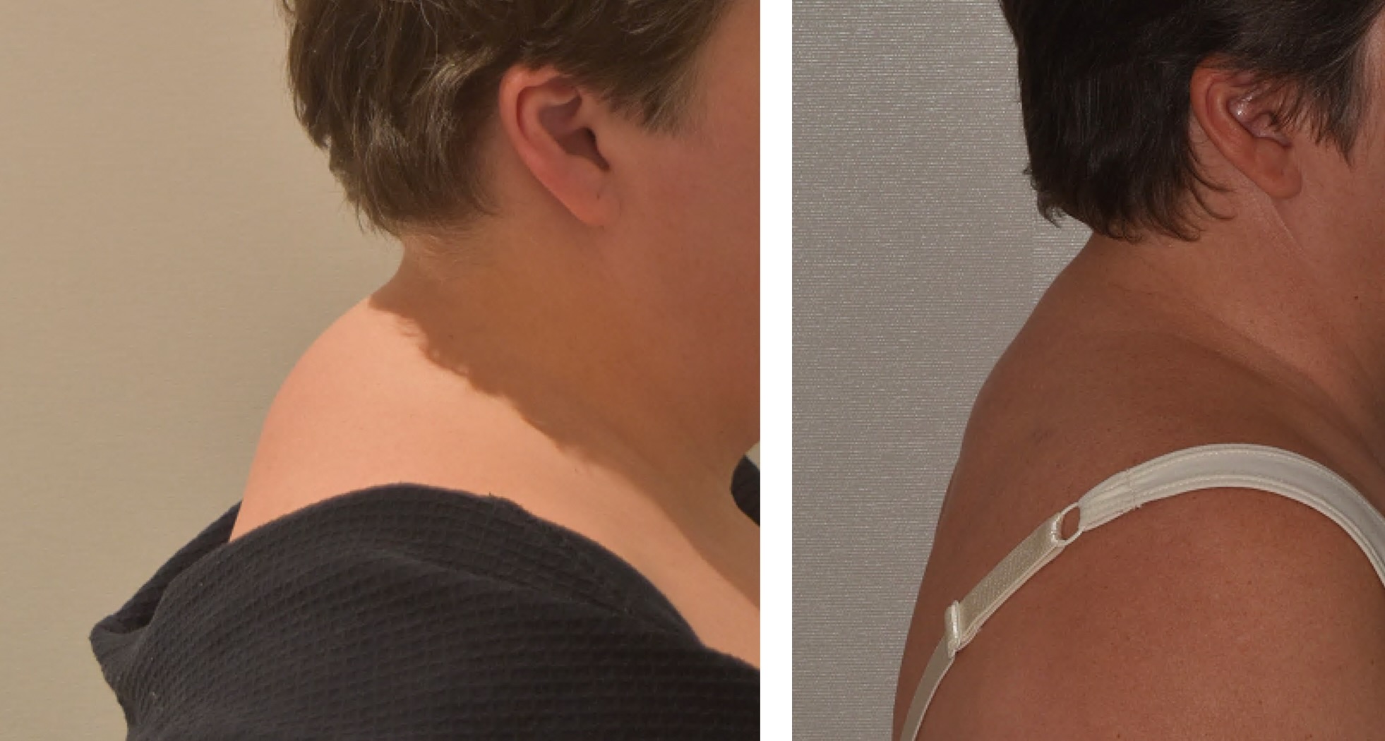 Before and after photographs, Photo 146.