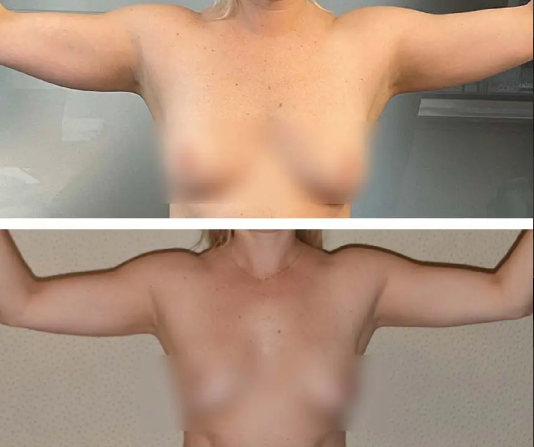 Before and after photographs, Photo 114.