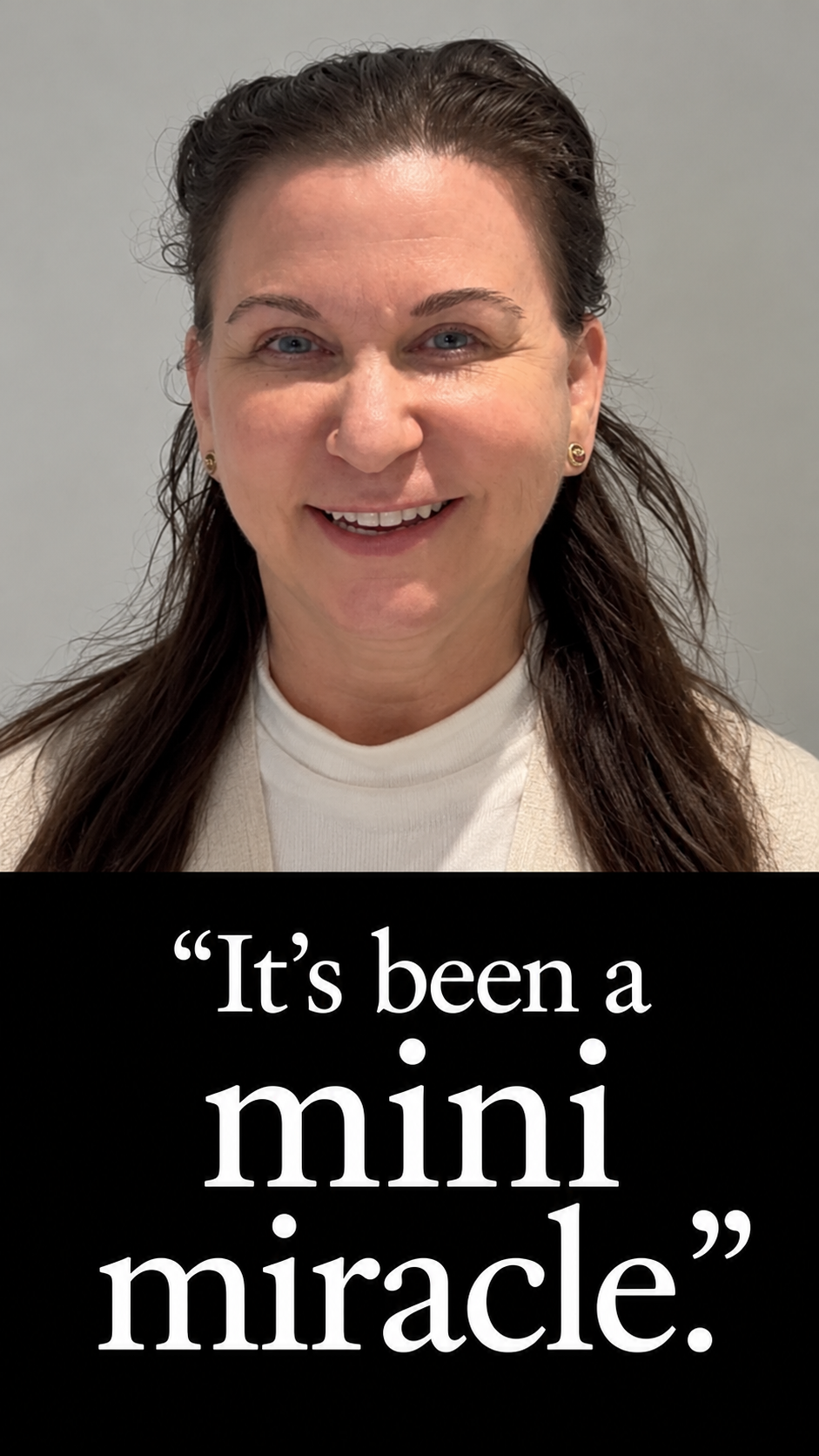 Video thumbnail: Fcelift and neck lift "mini miracle" in NYC