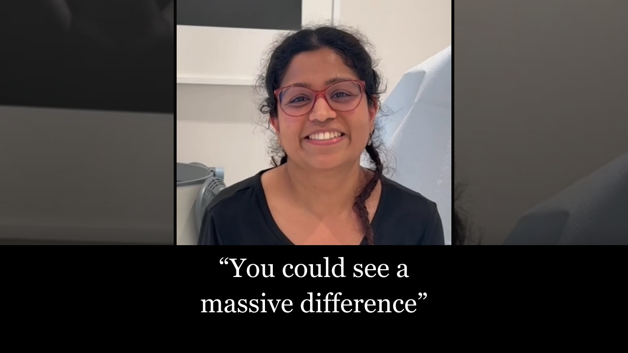 Video thumbnail: Arm Lift in NYC: "You Could See a Massive Difference" | Patient Testimonial