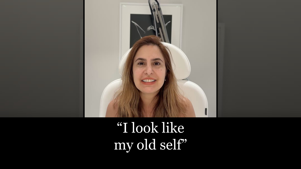 Video thumbnail: Jawline Liposuction: "I Look Like My Old Self" | NYC Patient Testimonial