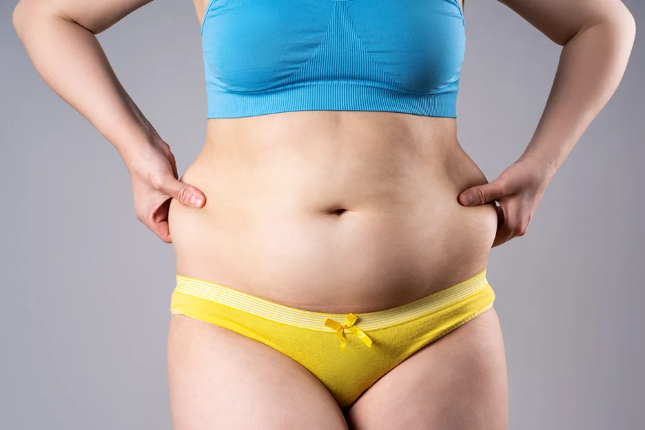 Woman pinching abdominal and flank tissue before body contouring