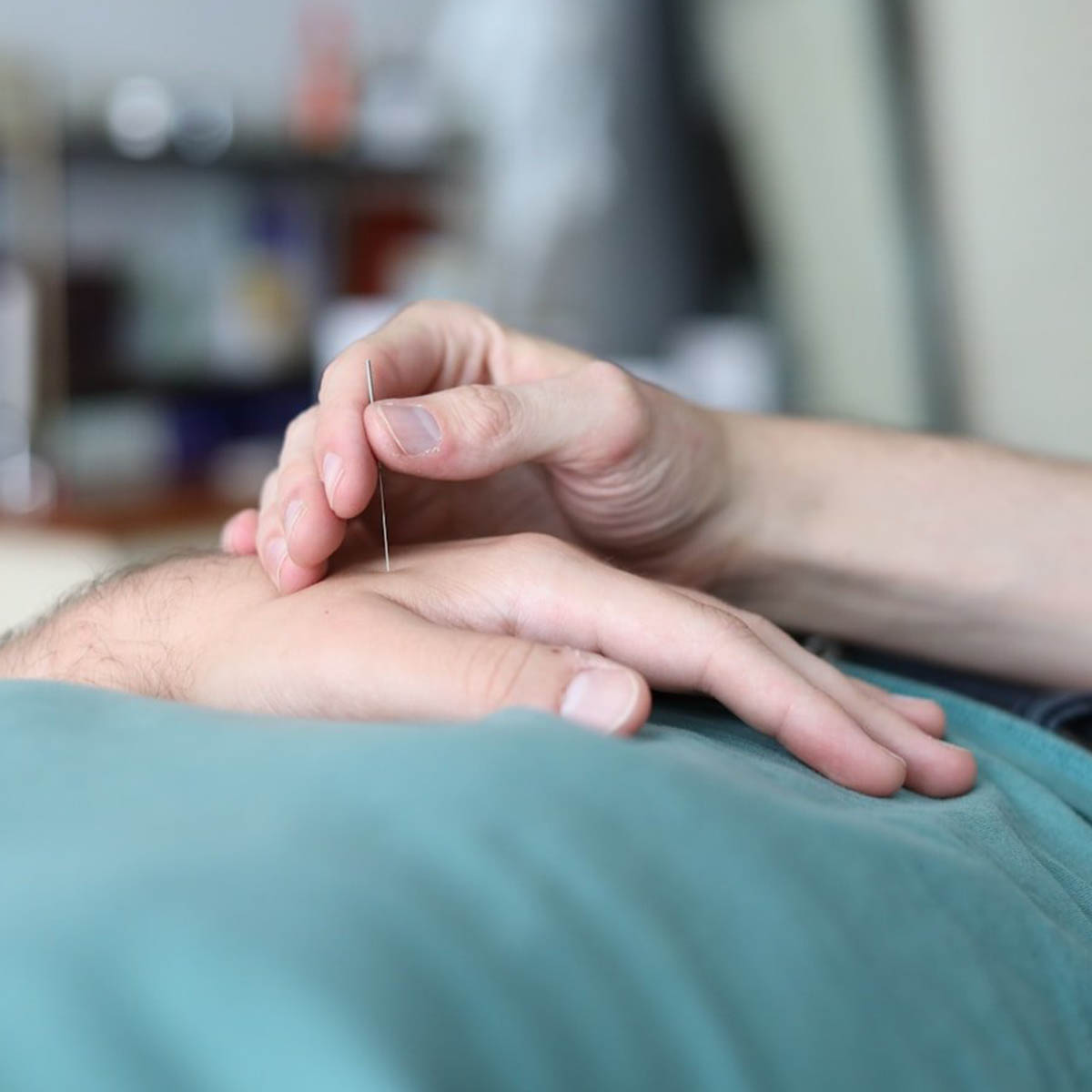 Acupuncture being appliend to the hand to relieve pain from Carpal Tunnel Syndrome.