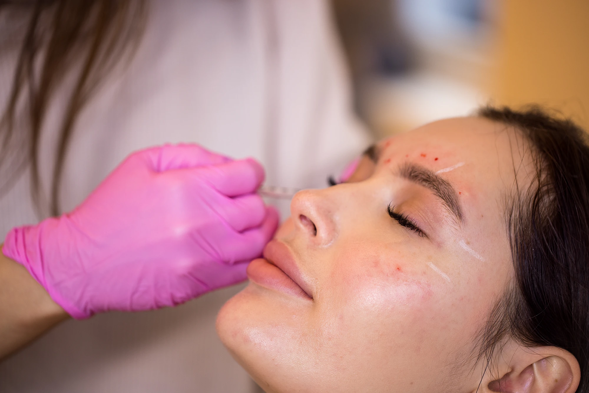 Exosome Therapy London