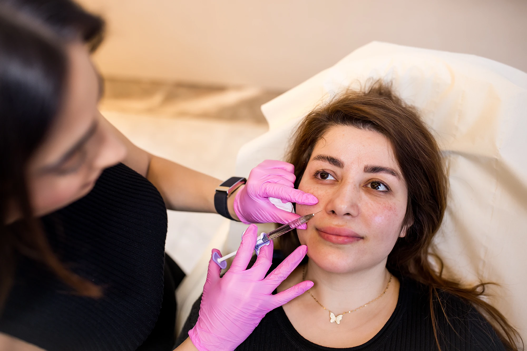 Nasolabial Filler London