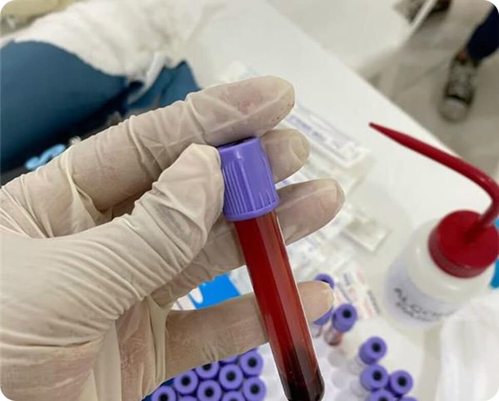 measured-biomarkers