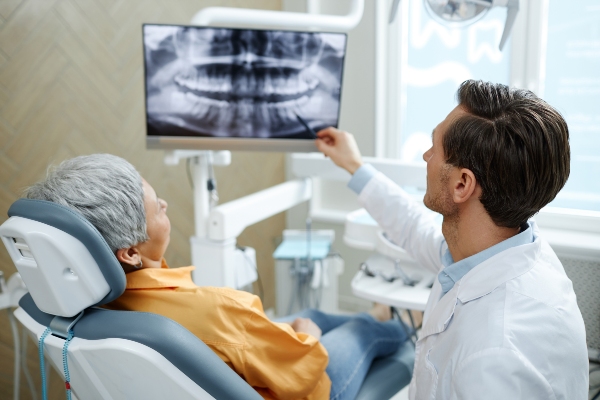 The Ultimate Guide to Receiving Dental Implants from Genuine Care Dental in Saratoga, CA