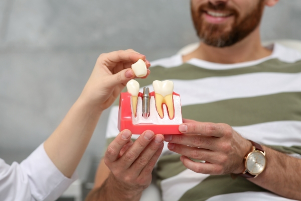 A General Dentist Explains the Process of Getting Dental Implants from Genuine Care Dental in Saratoga, CA