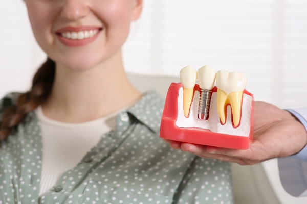 Factors To Consider Before Opting for Dental Implants from Genuine Care Dental in Saratoga, CA