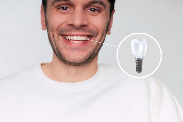 Dental Implants vs. Other Tooth Replacement Options from Genuine Care Dental in Saratoga, CA