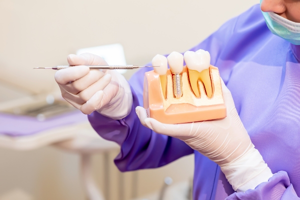The Potential Risks of Getting Dental Implants from Genuine Care Dental in Saratoga, CA