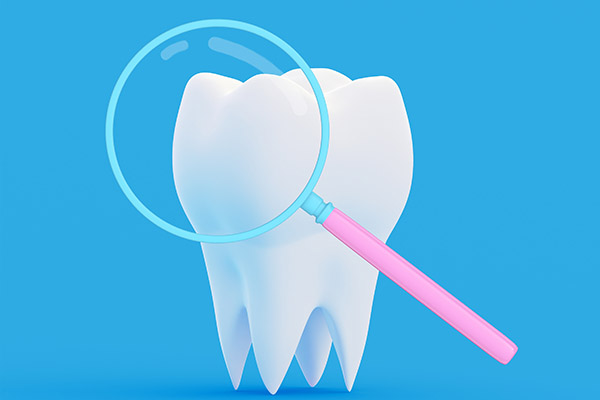 What to Expect When Getting a Dental Crown from Genuine Care Dental in Saratoga, CA