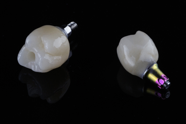 Dental Implants Saratoga, CA