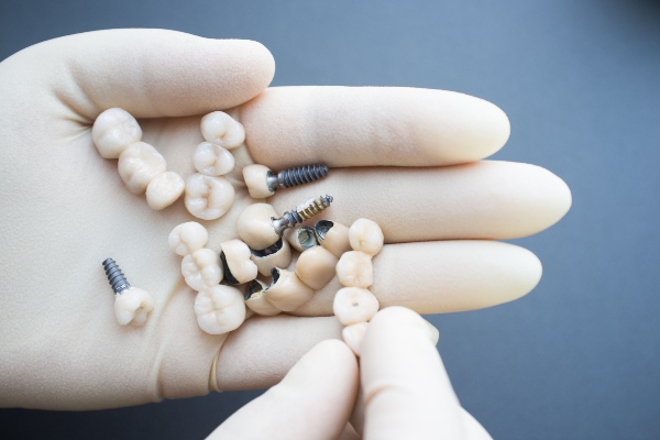 Dental Restoration Options for Damaged, Decayed, or Missing Teeth from Genuine Care Dental in Saratoga, CA