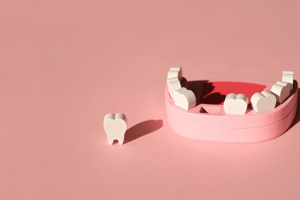 How a Family Dentist Can Replace Missing Teeth from Genuine Care Dental in Saratoga, CA