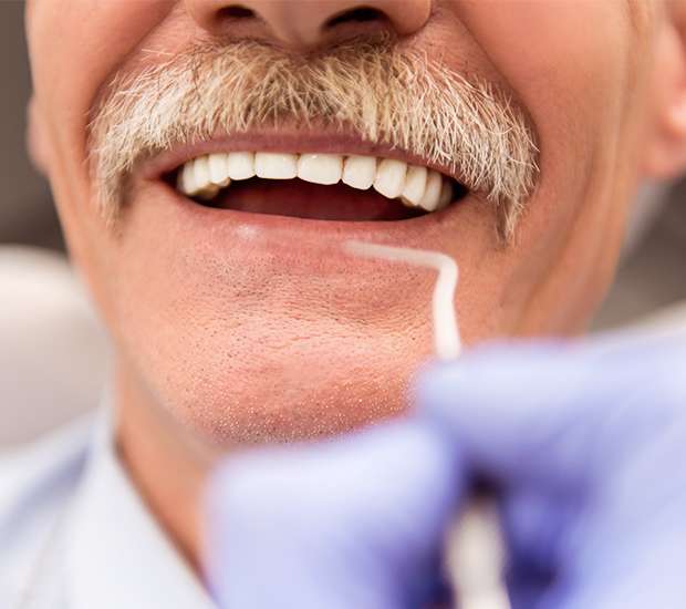 Adjusting to New Dentures from Genuine Care Dental in Saratoga, CA