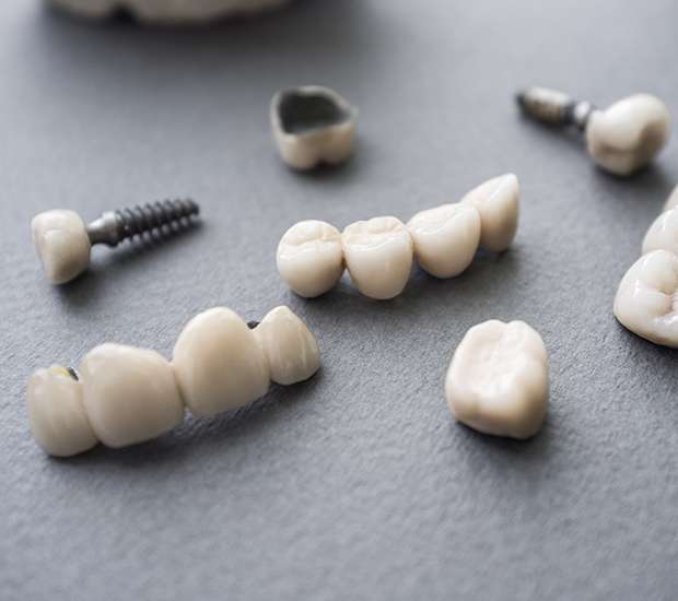 The Difference Between Dental Implants and Mini Dental Implants from Genuine Care Dental in Saratoga, CA