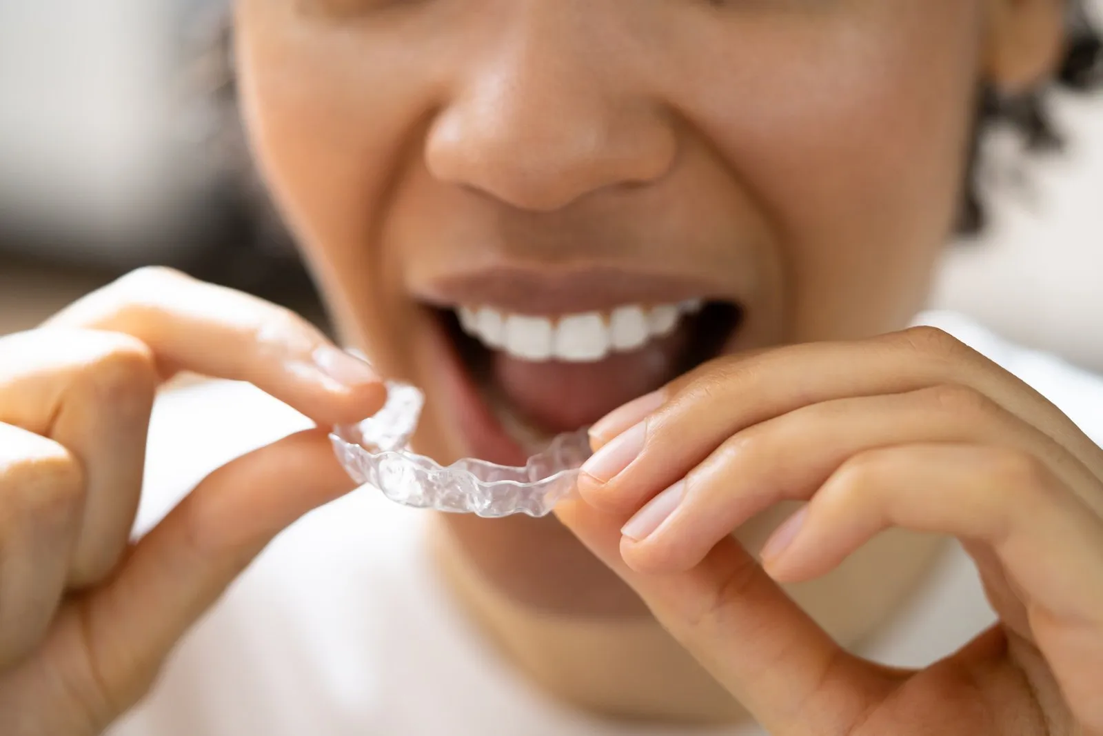 Close-up of a smiling patient inserting a clear Invisalign aligner