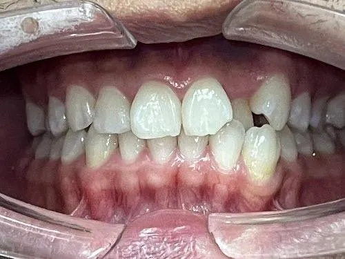 Case 01 before treatment