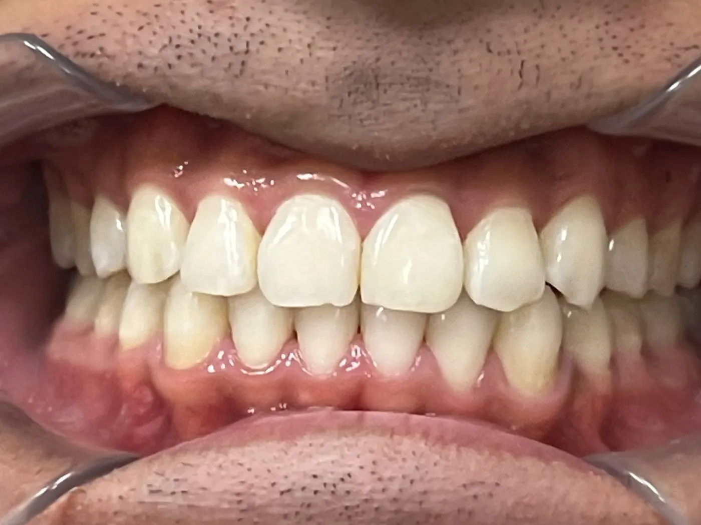 Case 01 after treatment