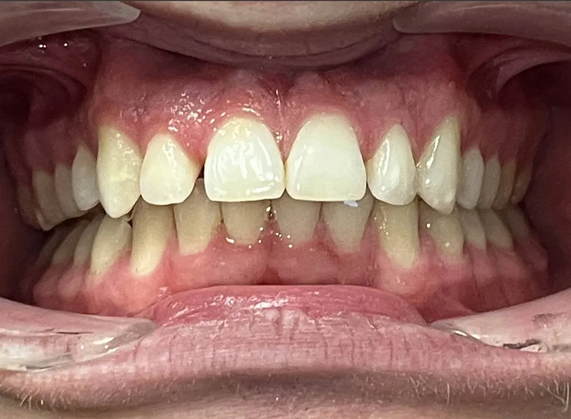 Case 02 before treatment