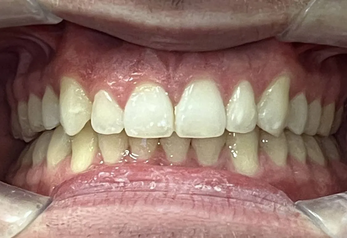 Case 02 after treatment