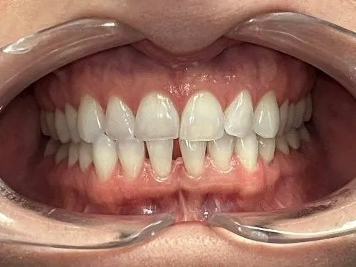 Case 04 before treatment