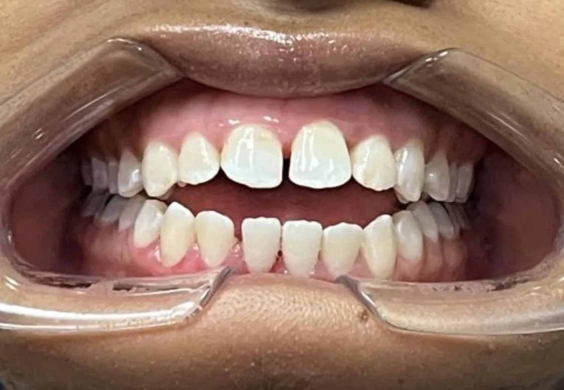 Case 06 before treatment