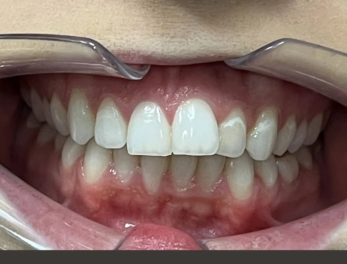 Case 07 before treatment