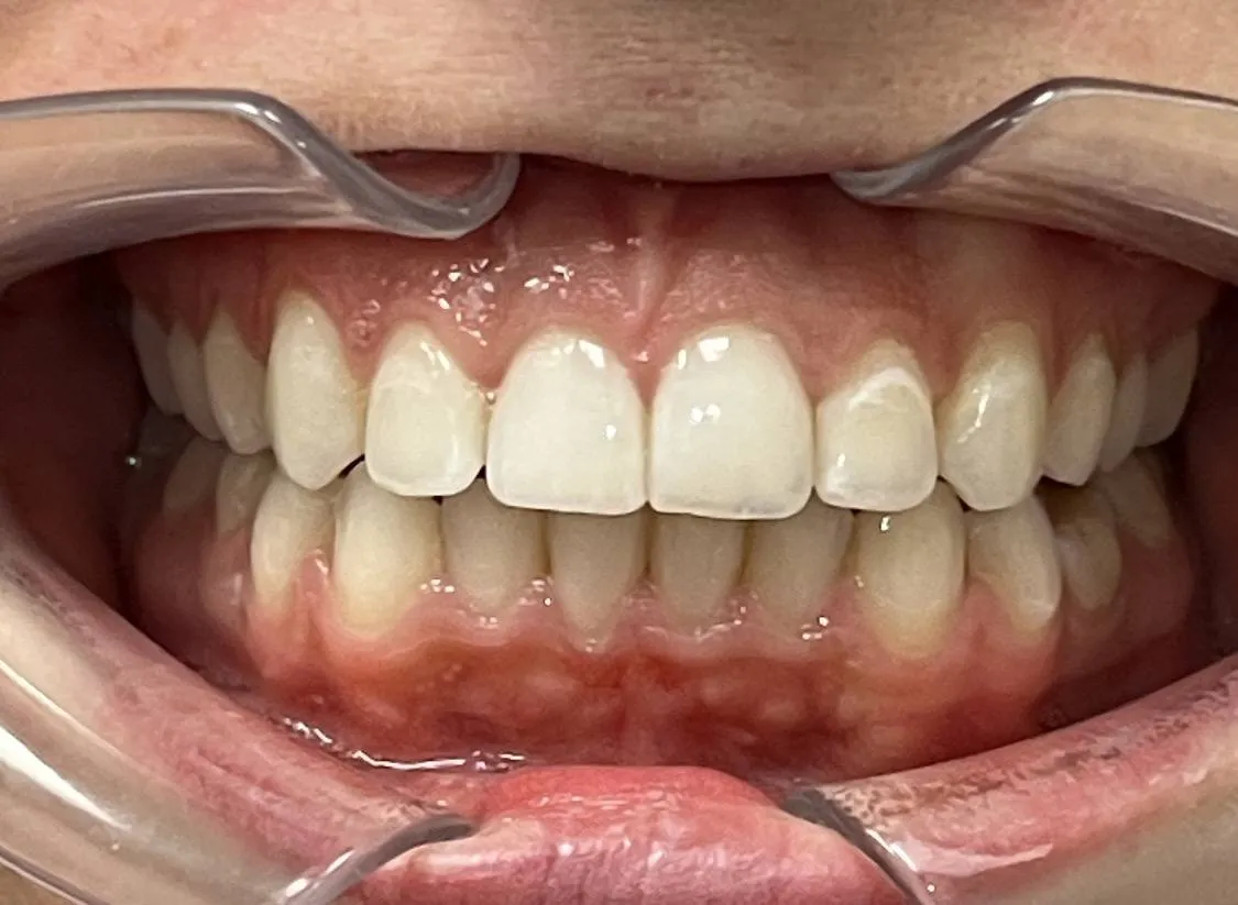 Case 07 after treatment