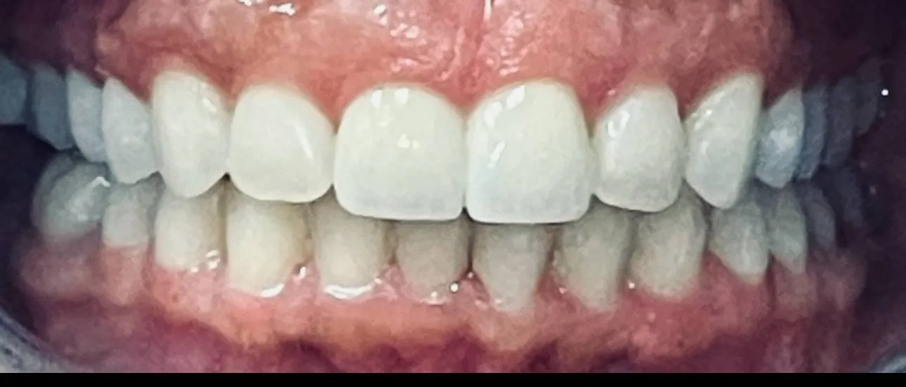 Case 08 after treatment