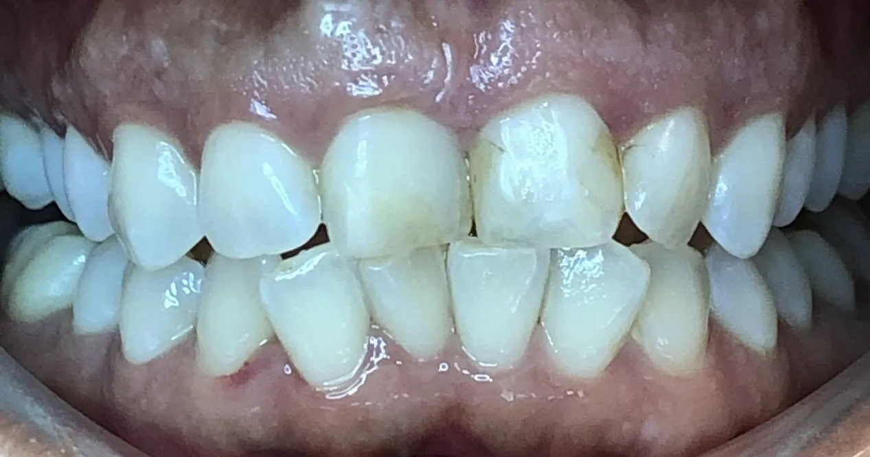 Case 08 before treatment