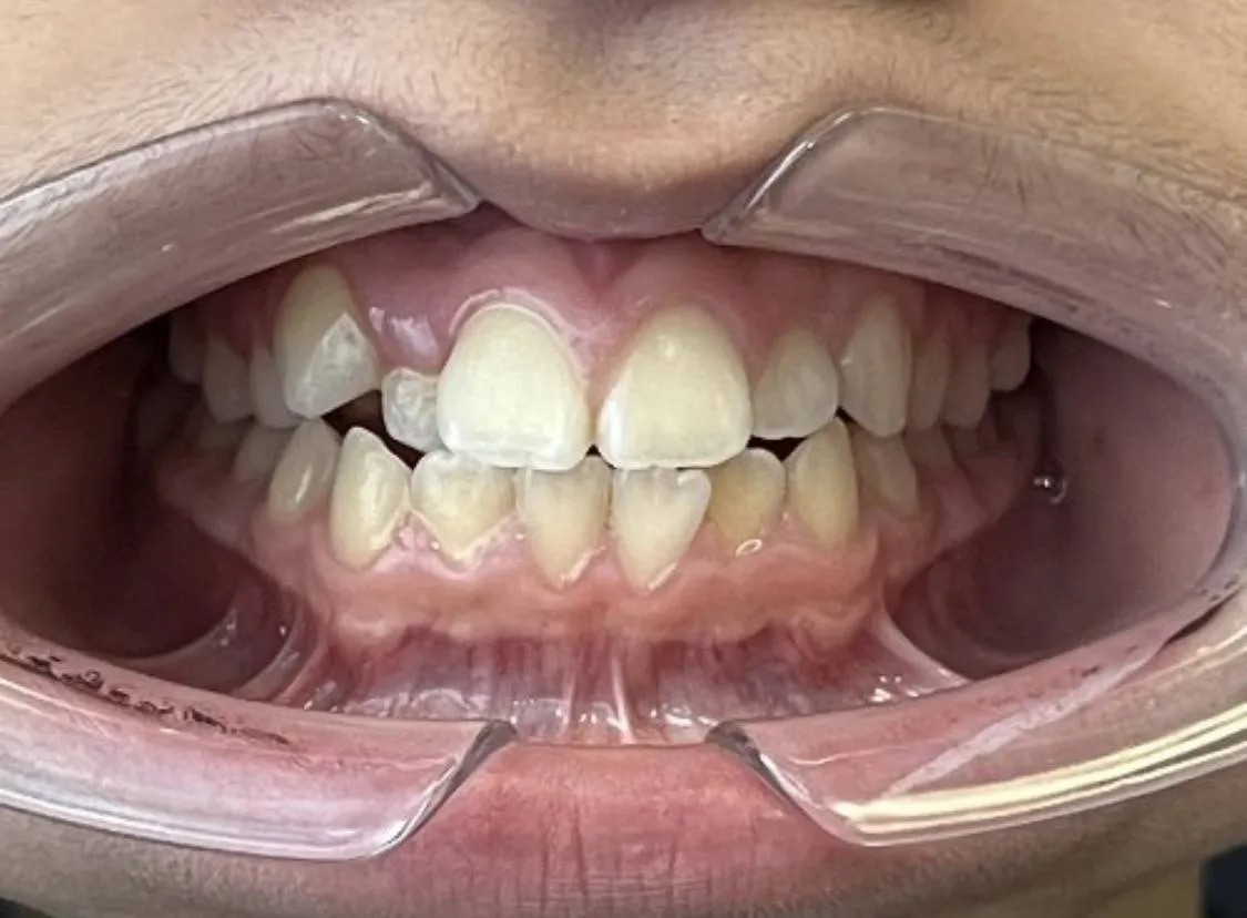 Case 09 before treatment